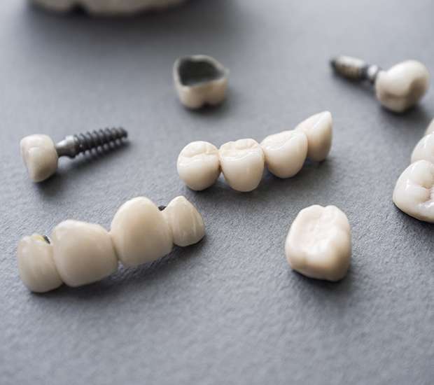Virginia Beach The Difference Between Dental Implants and Mini Dental Implants